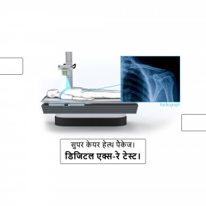 Illustration of an X-ray machine in operation with a chest radiograph displayed.