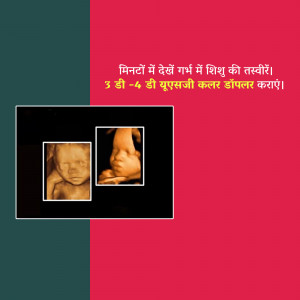 Image of a 3D/4D ultrasound scan of a fetus