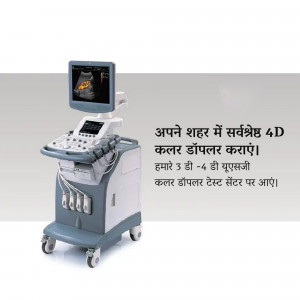 A gray and white 4D ultrasound machine with a screen displaying an ultrasound image.