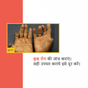 Close-up of hands with a snail, accompanied by text in Hindi about disease diagnosis and treatment.