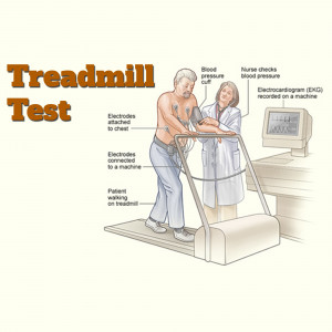 Illustration of a patient undergoing a treadmill stress test with a nurse monitoring their vitals.
