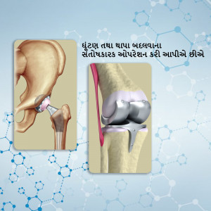 Illustration of a knee joint before and after replacement surgery