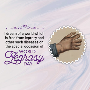 Image depicting a hand affected by leprosy with text promoting a world free from leprosy.