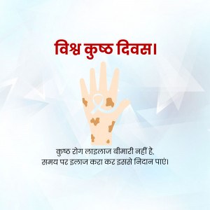 Image depicting a hand with vitiligo patches and text in Hindi promoting awareness about the condition.