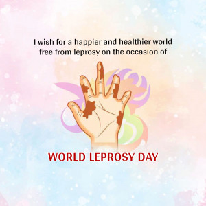 Image depicting a hand with signs of leprosy and text promoting World Leprosy Day.