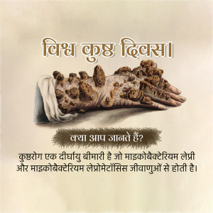 Image depicting the effects of leprosy on hands, with text in Hindi raising awareness.