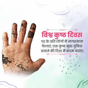 Image depicting a hand with leprosy symptoms and text in Hindi promoting World Leprosy Day.