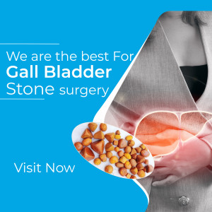 Image depicting gall bladder stones and a doctor, promoting gall bladder stone surgery.