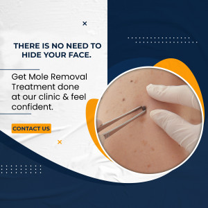 Image depicting mole removal procedure with text promoting confidence.