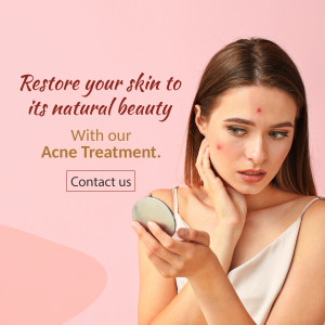 Woman looking at her skin with acne, promoting acne treatment.