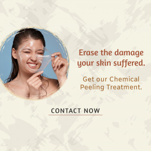 Woman applying a peeling mask with text promoting chemical peeling treatment.