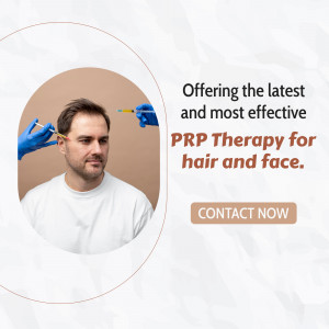 A man receiving PRP therapy with a doctor injecting into his scalp.