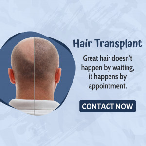 Hair transplant before and after results showing hair restoration.