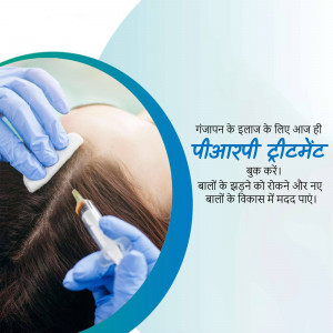 Image depicting a PRP treatment being administered to the scalp.