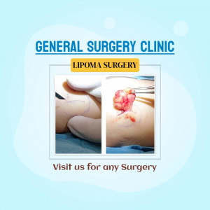 Image showcasing lipoma surgery performed at a general surgery clinic.