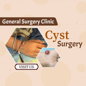 Image depicting cyst surgery performed by a medical professional.