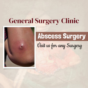 Image depicting an abscess on skin, advertising abscess surgery services at a general surgery clinic.