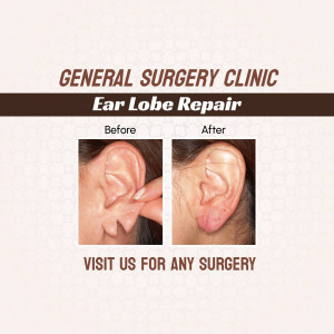 Before and after photos of ear lobe repair surgery at a general surgery clinic.