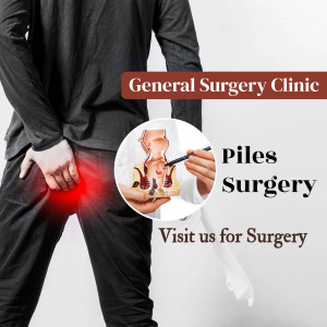 Image depicting piles surgery information at a general surgery clinic.