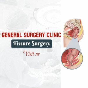 Image depicting a general surgery clinic specializing in fissure surgery, with an anatomical illustration of the anal canal.