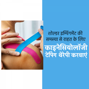 Kinesiology tape applied to a shoulder for impingement relief