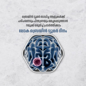 Illustration of a human brain with a highlighted tumor.