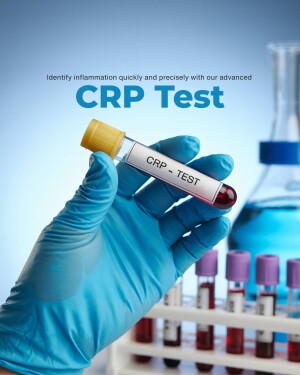 A gloved hand holding a blood sample tube labeled 'CRP Test' with laboratory equipment in the background.