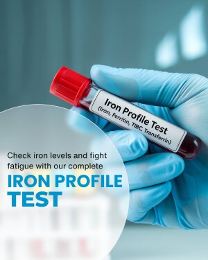 A gloved hand holding a blood vial labeled 'Iron Profile Test'