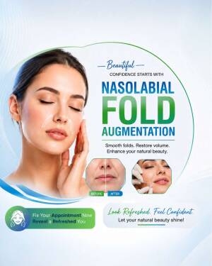A medical aesthetic poster showing a woman with nasolabial fold filler treatment before and after results