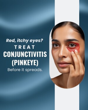 Woman with red, itchy eyes and text promoting treatment for conjunctivitis (pinkeye).
