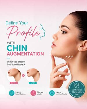 A medical poster promoting chin augmentation featuring a profile shot of a woman with before and after comparisons.