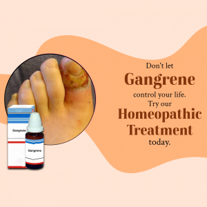 Homeopathic Treatment For Gangrene Post For LinkedIn