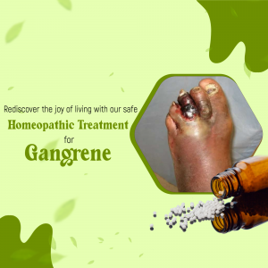 Homeopathic Treatment For Gangrene Graphic For X