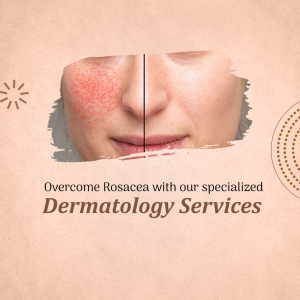 Rosacea Treatment Dermatology Services Marketing Image For WhatsApp