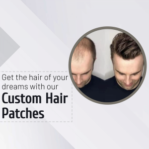 Custom Hair Patch Before And After Results Promotional Banner For WhatsApp