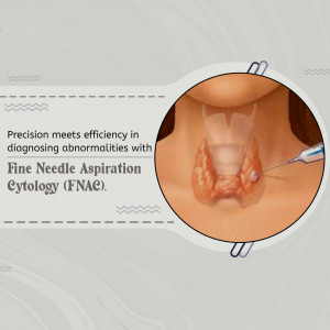 Understanding Fine Needle Aspiration Cytology (FNAC) For Thyroid Diagnosis Artwork For Pinterest