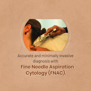 Fine Needle Aspiration Cytology (FNAC) Procedure Post For Google Business Profile